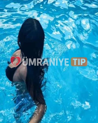 EDA fotoğrafı